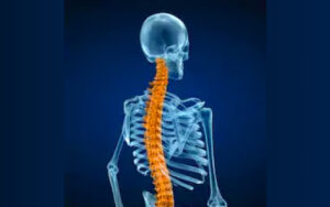 perils of spondylitis