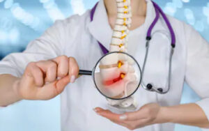 recurrent osteoid osteoma