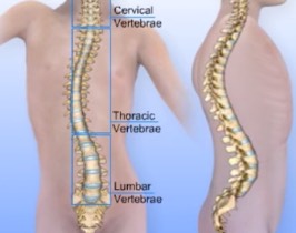 SCOLIOSIS SURGERY