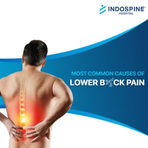 lower back pain treatment