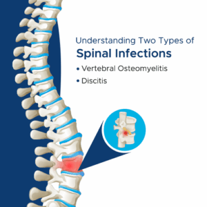 spinal infections treatment