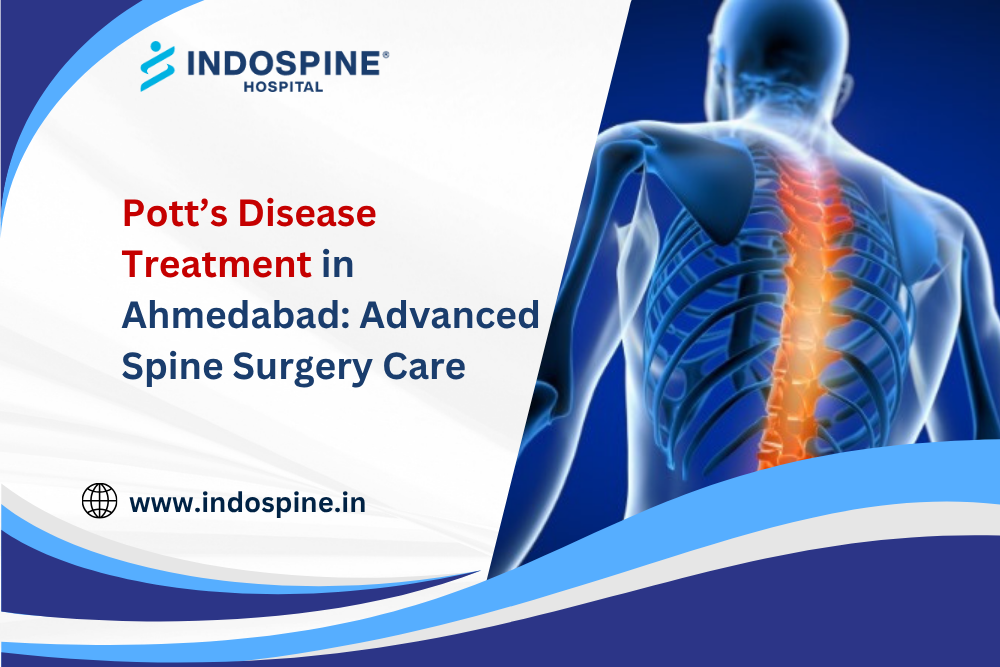 Pott’s Disease Treatment