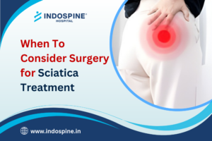 Sciatica Treatment