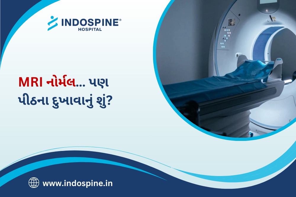 MRI Normal But What about Back Pain